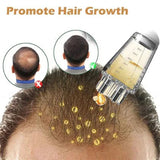 Mini Hair Oil Scalp Applicator